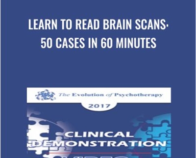 Learn to Read Brain Scans: 50 cases in 60 Minutes - Daniel Amen