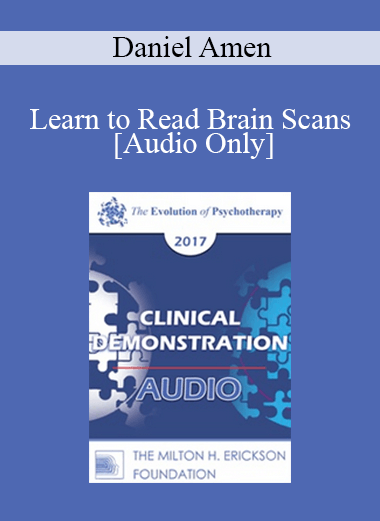 [Audio] EP17 Clinical Demonstration 10 - Learn to Read Brain Scans: 50 cases in 60 Minutes - Daniel Amen