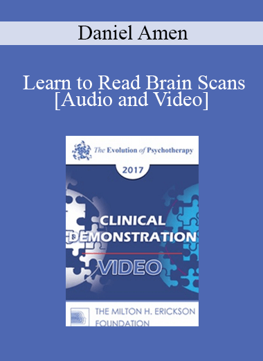 EP17 Clinical Demonstration 10 - Learn to Read Brain Scans: 50 cases in 60 Minutes - Daniel Amen