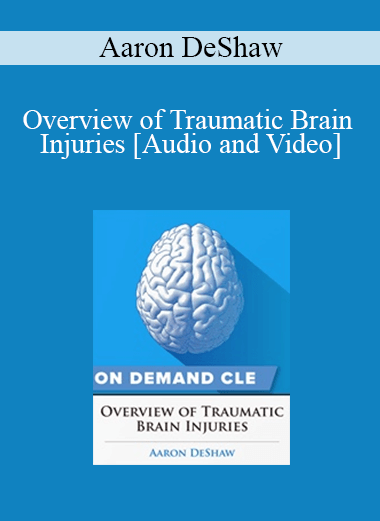 Trial Guides - Overview of Traumatic Brain Injuries