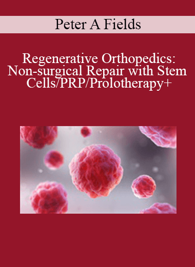 Peter A Fields - Regenerative Orthopedics: Non-surgical Repair with Stem Cells/PRP/Prolotherapy+