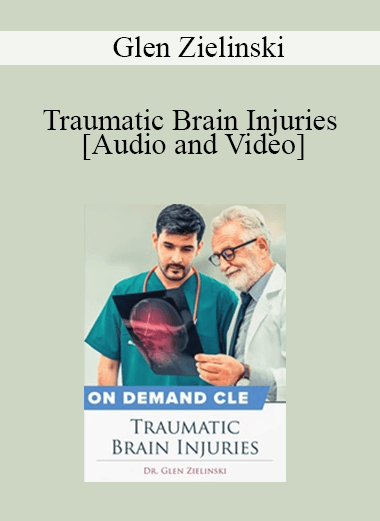 Trial Guides - Traumatic Brain Injuries