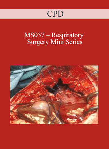 CPD - MS057 – Respiratory Surgery Mini Series
