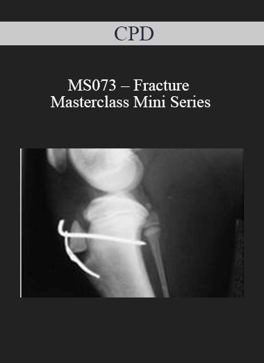 CPD - MS073 – Fracture Masterclass Mini Series