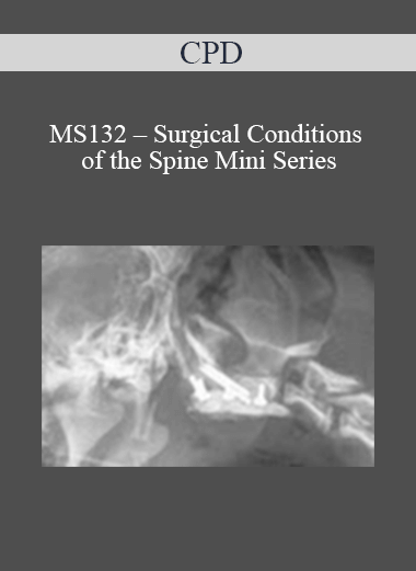 CPD - MS132 – Surgical Conditions of the Spine Mini Series