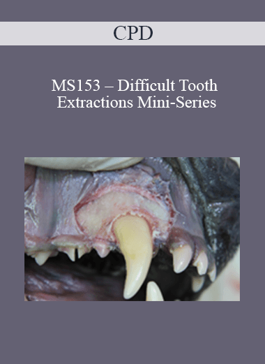 CPD - MS153 – Difficult Tooth Extractions Mini-Series