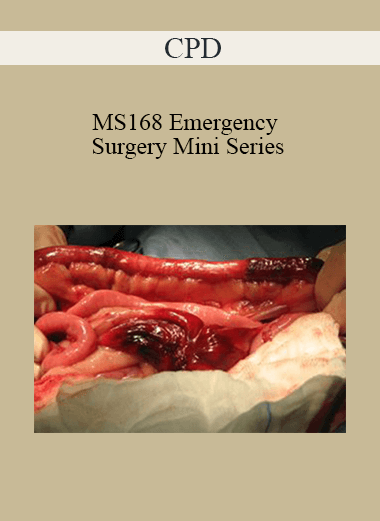 CPD - MS168 Emergency Surgery Mini Series