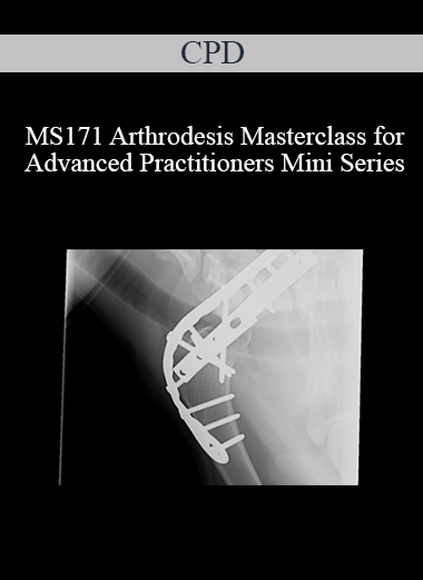 CPD - MS171 Arthrodesis Masterclass for Advanced Practitioners Mini Series