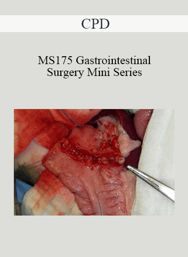 CPD - MS175 Gastrointestinal Surgery Mini Series