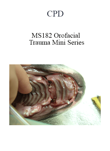 CPD - MS182 Orofacial Trauma Mini Series
