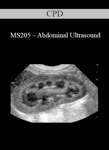 CPD - MS205 – Abdominal Ultrasound