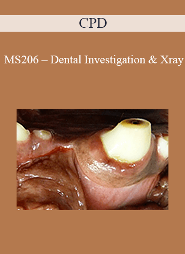 CPD - MS206 – Dental Investigation & Xray