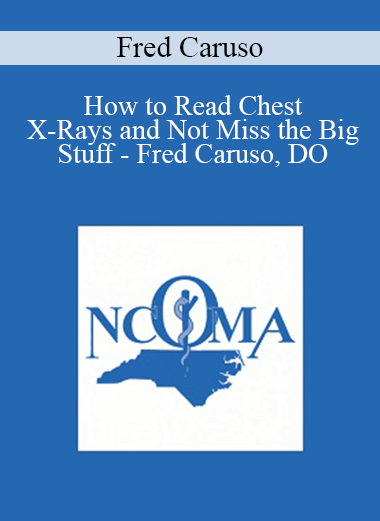 Fred Caruso - How to Read Chest X-Rays and Not Miss the Big Stuff - Fred Caruso