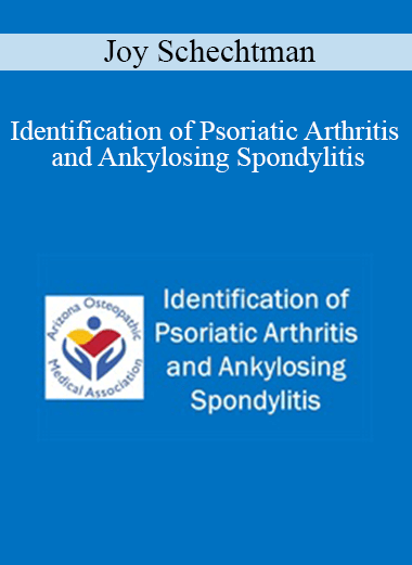 Joy Schechtman - Identification of Psoriatic Arthritis and Ankylosing Spondylitis